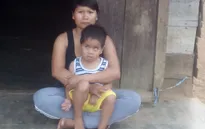 Bé 4 tuổi nguy kịch vì u nguyên bào võng mạc