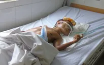 Sự sống mong manh của người đàn ông tàn tật 40 tuổi nặng 5kg