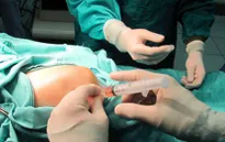 Bộ Y tế cho phép chữa thoái hóa khớp gối bằng tế bào gốc