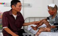 Bé trai 9 tuổi mắc vảy cá bẩm sinh hiếm gặp