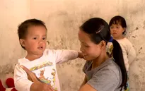 Hành trình hồi sinh kỳ diệu của em nhỏ bị tim bẩm sinh phức tạp