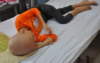 Xót thương bé gái 9 tuổi vừa mổ tim lại bị ung thư xương
