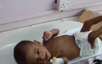 Những đứa trẻ bị mắc kẹt trong cuộc khủng hoảng tại Yemen