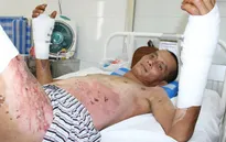 Cha nguy kịch vì bỏng điện, bầy con thơ đói khát