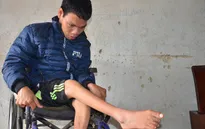 Khốn đốn gia cảnh mẹ tâm thần, con bại liệt