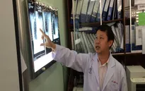 Nữ bệnh nhân suýt chết vì hạt mãng cầu chui vào phổi