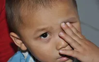 Mẹ ơi, mắt của con “trốn” đi đâu rồi?