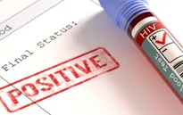 Làm thế nào để biết phương pháp điều trị HIV có hiệu quả?