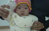 Bố mẹ bất lực nhìn con gái 8 tháng tuổi nguy kịch trước bệnh tim bẩm sinh