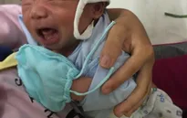 Thương bé 20 ngày tuổi thân hình tím tái vì bệnh tim bẩm sinh