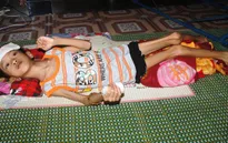Xót xa trước bé 10 tuổi chỉ nặng... 12kg vì bệnh hiểm nghèo