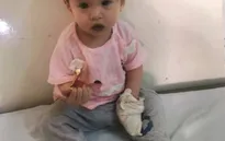 Ánh mắt cầu cứu của bé gái tim bẩm sinh 11 tháng tuổi
