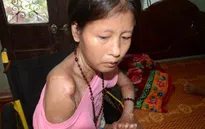 Bố chết, mẹ liệt nửa người, 3 đứa trẻ sống trong khốn khó