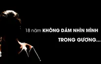 Hành trình tìm lại nụ cười của cô gái "ma cà rồng"