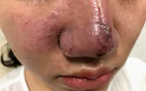 Hà Nội tăng cường kiểm tra, xử lý hoạt động của các cơ sở dịch vụ thẩm mỹ