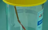 Tăm tre dài 6cm đâm thủng ruột bé trai