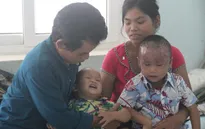 Nhói lòng nhìn 2 cháu nhỏ vùng cao bị lở loét hết da đầu