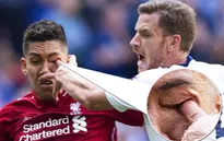 Cận cảnh pha "móc mắt" ghê rợn trong trận Tottenham - Liverpool