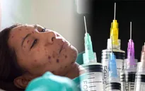 Dịch sởi bùng phát ở châu Âu do không tiêm phòng