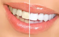 Tự làm kem đánh răng siêu trắng trong tích tắc tại nhà