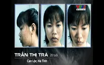 Change Life 2018: Cô sinh viên trường y tự tin sau phẫu thuật thẩm mĩ
