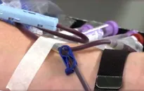 Cạn nguồn máu dự trữ tại Mỹ do chính phủ đóng cửa một phần