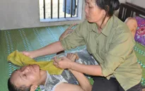 Bị ấu trùng giun đũa chó, người đàn bà khốn khổ không được đi viện vì phải ở nhà chăm 2 em thần kinh