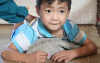 Xót thương cha và con ôm nhau khóc trên giường vì cùng bị hoại tử xương đùi