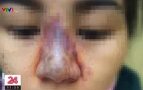 Một phụ nữ ngưng tim, ngưng thở sau khi tiêm thuốc gây mê tại thẩm mỹ viện