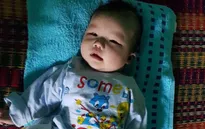 Dị tật không lá lách, tim bẩm sinh, bé trai 4 tháng nguy kịch