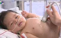 Bệnh nhi tim bẩm sinh phức tạp 2 tháng tuổi thoi thóp chờ sự giúp đỡ