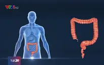 Những dấu hiệu và cách phòng ung thư đại trực tràng