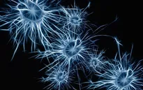 Phát hiện sự liên quan giữa tế bào miễn dịch ở não và bệnh Alzheimer