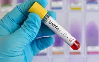 Tây Ban Nha ghi nhận thêm ca tử vong do nhiễm khuẩn Listeria