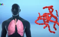 Bệnh viêm phổi do chủng virus mới diễn biến phức tạp