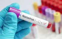 Hàng loạt sinh viên Trung Quốc nhiễm Norovirus