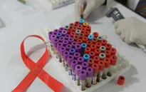 Thế giới có bệnh nhân thứ hai tự khỏi HIV