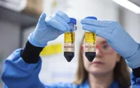 Astrazeneca có thể thử nghiệm lại vaccine ngừa COVID-19