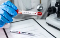 Hai người Iran tử vong sau khi bị phát hiện dương tính với COVID-19