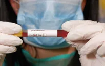 Hà Lan phát hiện trường hợp đầu tiên nhiễm COVID-19