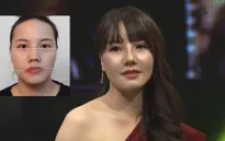 Change Life: Cô gái mặt lệch "lột xác" trở thành người mẫu thời trang