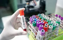 Nga phát triển 3 loại thuốc hỗ trợ điều trị COVID-19