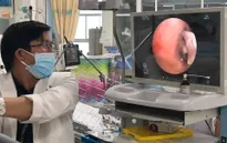 Hóc đốt xương lươn vào phổi, bé 7 tháng tuổi nguy kịch