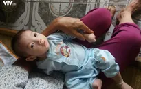 Trái tim cho em mang lại sự sống kịp thời cho bệnh nhi tim bẩm sinh 6 tháng tuổi