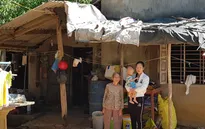 Bệnh nhi tim bẩm sinh 1 tuổi cần được hỗ trợ phẫu thuật gấp