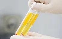 Điều trị bằng huyết tương cung cấp ngay kháng thể cho bệnh nhân COVID-19 để diệt virus