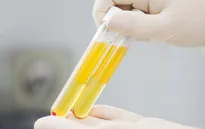 Bắt đầu sử dụng huyết tương điều trị bệnh nhân COVID-19