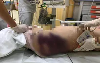 Bé gái 8 tuổi tử vong nghi bị người tình của cha bạo hành