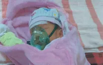 Em bé sinh đôi 2 tháng tuổi mắc bệnh tim bẩm sinh, không có tiền phẫu thuật