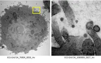 Càng nhiều người nhiễm SARS-CoV-2, virus càng có cơ hội biến chủng